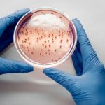 petri dish with live bacteria