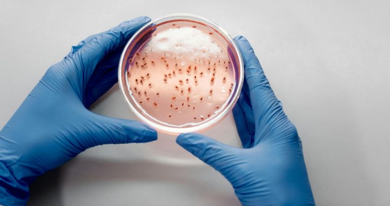 petri dish with live bacteria